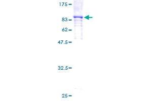 Image no. 2 for Ribosomal Protein S6 Kinase, 90kDa, Polypeptide 5 (RPS6KA5) (AA 1-549) protein (GST tag) (ABIN1318830)