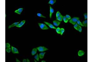 Immunofluorescence staining of Hela cells with ABIN7142520 at 1:100, counter-stained with DAPI. (RPS23 抗体  (AA 2-143))