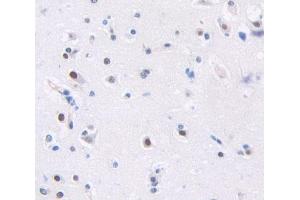 Used in DAB staining on fromalin fixed paraffin- embedded Kidney tissue (Arx 抗体  (AA 25-246))