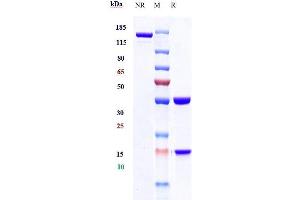 Anti-IFNg Reference Antibody (fontolizumab) on SDS-PAGE under reducing (R) condition. (Recombinant IFNG (Fontolizumab Biosimilar) 抗体)