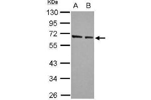 WB Image Sample (30 ug of whole cell lysate) A: A549 B: HeLa 10% SDS PAGE antibody diluted at 1:5000 (KLF4 抗体  (C-Term))