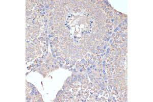 Immunohistochemistry (IHC) image for anti-Cytochrome C Oxidase Subunit Va (COX5A) (AA 1-150) antibody (ABIN6138912)