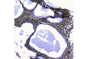 IHC analysis of Lumican using anti-Lumican antibody (ABIN6719339).