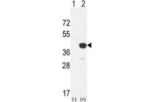 Western Blotting (WB) image for anti-Cathepsin K (CTSK) antibody (ABIN3003176) (Cathepsin K 抗体)