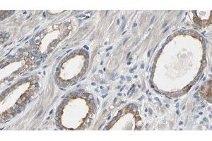 ABIN6277566 at 1/100 staining Human prostate tissue by IHC-P. (EEF2K 抗体  (Internal Region))