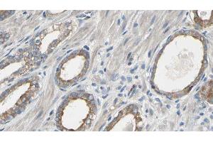 ABIN6277566 at 1/100 staining Human prostate tissue by IHC-P.