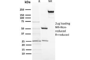 SDS-PAGE Analysis Purified ACTH Mouse Monoclonal Antibody (57). (POMC 抗体  (N-Term))