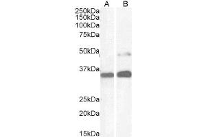 ABIN184783 (1µg/ml) staining of Human Kidney (A) and HeLa cell (B) lysate (35µg protein in RIPA buffer). (PAX8 抗体  (N-Term))