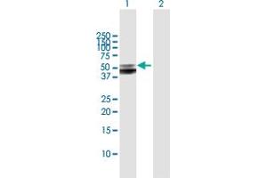 Western Blot analysis of SERPINA12 expression in transfected 293T cell line by SERPINA12 MaxPab polyclonal antibody.