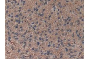 Immunohistochemistry (IHC) image for anti-Annexin A6 (ANXA6) (AA 2-251) antibody (ABIN7434836)
