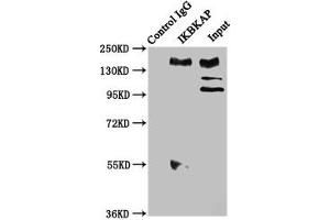 Western Blotting (WB) image for anti-Elongator Complex Protein 1 (ELP1) (AA 1107-1258) antibody (ABIN7151572)
