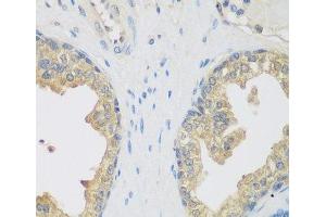 Immunohistochemistry of paraffin-embedded Human prostate using ENPEP Polyclonal Antibody at dilution of 1:200 (40x lens). (ENPEP 抗体)