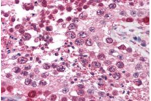 Human Testis (formalin-fixed, paraffin-embedded) stained with TRIM17 antibody ABIN213719 at 2. (TRIM17 / RNF16 抗体  (AA 254-303))