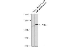 Western blot analysis of extracts of various cell lines using CAPN3 Polyclonal Antibody at dilution of 1:3000. (Calpain 3 抗体)