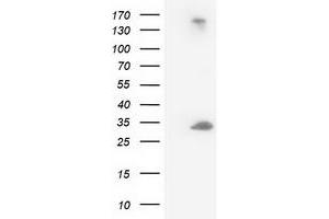 HEK293T cells were transfected with the pCMV6-ENTRY control (Left lane) or pCMV6-ENTRY DCK (Right lane) cDNA for 48 hrs and lysed. (DCK 抗体)