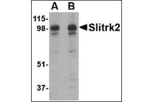 Western blot analysis of Slitrk2 in rat brain tissue lysate with this product at (A) 1 and (B) 2 μg/ml. (SLITRK2 抗体  (C-Term))