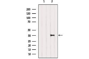 Western blot analysis of extracts from Mouse lung, using IkappaB-alpha Antibody. (NFKBIA 抗体  (C-Term))