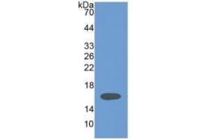 WB of Protein Standard: different control antibodies  against Highly purified E. (HPSE ELISA 试剂盒)