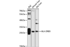 Western blot analysis of extracts of various cell lines, using HLA-DRB3 antibody (ABIN6131761, ABIN6141833, ABIN6141834 and ABIN6216072) at 1:1000 dilution. (HLA-DRB3 抗体  (AA 30-227))