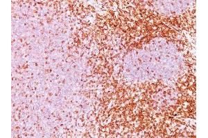 Image no. 1 for anti-CD6 (CD6) antibody (ABIN6160102) (CD6 抗体)