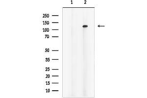 Western blot analysis of lysates from mouse lung tissue, using OGDH Antibody.