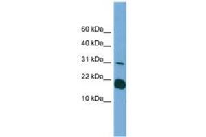 Image no. 1 for anti-Interleukin 1 delta (FIL1d) (C-Term) antibody (ABIN6745104) (FIL1d 抗体  (C-Term))