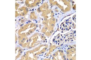 Immunohistochemistry of paraffin-embedded human kidney using WIPI2 antibody at dilution of 1:100 (x400 lens).