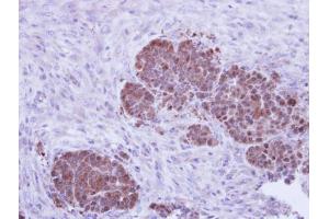IHC-P Image Immunohistochemical analysis of paraffin-embedded NCIN87 xenograft, using ZNF259, antibody at 1:500 dilution. (ZNF259 抗体  (Center))