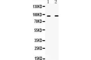 Western blot analysis of IFNGR1 using anti-IFNGR1 antibody . (IFNGR1 抗体  (C-Term))