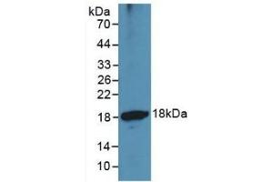 Detection of Recombinant ADAMTS1, Human using Monoclonal Antibody to A Disintegrin And Metalloproteinase With Thrombospondin 1 (ADAMTS1) (ADAMTS1 抗体  (AA 476-614))