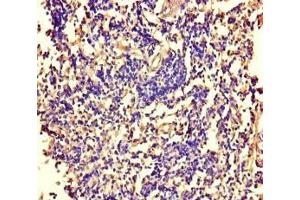 Immunohistochemistry of paraffin-embedded human tonsil tissue using ABIN7169007 at dilution of 1:100 (ARAF 抗体  (AA 160-310))