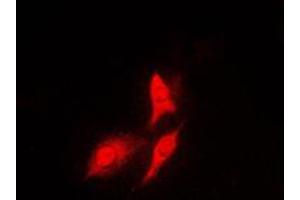 Immunofluorescent analysis of S6K1 staining in HeLa cells. (RPS6KB1 抗体  (C-Term))