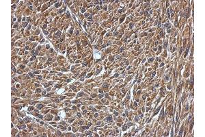 IHC-P Image Immunohistochemical analysis of paraffin-embedded U87 xenograft, using VAMP1, antibody at 1:500 dilution. (VAMP1 抗体)
