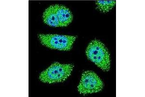 Confocal immunofluorescent analysis of PAK6 Antibody (Center) Cat. (PAK6 抗体  (Middle Region))