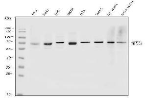 Western blot analysis of METTL3 using anti-METTL3 antibody (ABIN7602366).