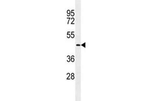 TMPRSS11E2 antibody western blot analysis in NCI-H292 lysate. (TMPRSS11E 抗体  (AA 249-277))