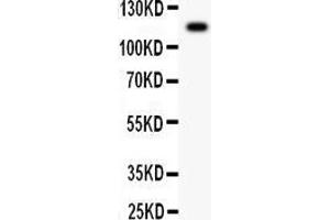 Anti- C5A antibody, Western blotting All lanes: Anti C5A  at 0. (C5 抗体  (AA 1-77))