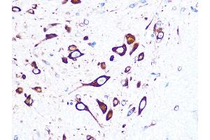 Immunohistochemistry of paraffin-embedded mouse spinal cord using FMRP Rabbit mAb (ABIN1679778, ABIN3019025, ABIN3019026 and ABIN7101703) at dilution of 1:100 (40x lens). (FMR1 抗体)