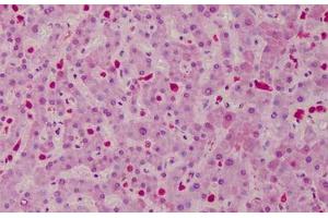Human Liver: Formalin-Fixed, Paraffin-Embedded (FFPE) (CARD11 抗体  (AA 18-238))