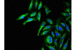 Immunofluorescent analysis of Hela cells using ABIN7159980 at dilution of 1:100 and Alexa Fluor 488-congugated AffiniPure Goat Anti-Rabbit IgG(H+L) (MAPK11 抗体  (AA 310-362))