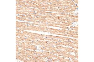 Immunohistochemistry (IHC) image for anti-Kelch-Like 9 (KLHL9) (AA 1-100) antibody (ABIN6142940)