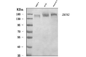 Western blot analysis of RAMP/ZMYM2 using anti-RAMP/ZMYM2 antibody (ABIN7602071).