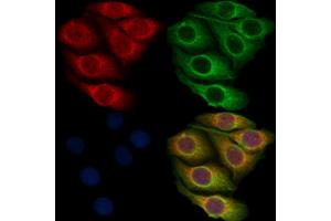 ABIN7093376 and ABIN7097396 staining Hela cells by IF/ICC. (MAP3K3 抗体)