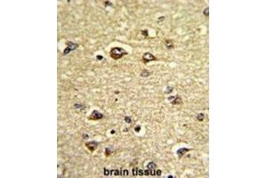 Immunohistochemistry (IHC) image for anti-Growth Arrest-Specific 7 (GAS7) antibody (ABIN3002729) (GAS7 抗体)