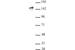 STAG1 antibody (pAb) tested by Western blot. (Stromal Antigen 1 抗体  (C-Term))