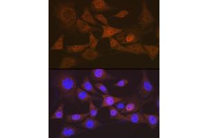 Immunofluorescence analysis of NIH-3T3 cells using eIF2B epsilon (EIF2B5) (EIF2B5) Rabbit mAb (ABIN7267038) at dilution of 1:100 (40x lens).