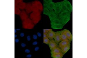 ABIN6258807 and ABIN6273863 staining Hela cells(30 min of UV treatment) by IF/ICC. (GPR25 抗体  (Internal Region))