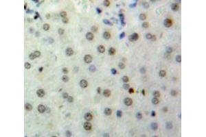 Used in DAB staining on fromalin fixed paraffin-embedded Liver tissue (HIST2H2BE 抗体  (AA 2-126))