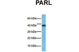 Host:  Rabbit  Target Name:  PARL  Sample Tissue:  Human Jurkat  Antibody Dilution:  1. (PARL 抗体  (N-Term))