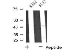 Western blot analysis of extracts from K562 cells, using UBFD1 antibody.